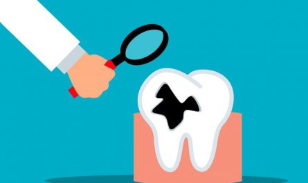 Rêver de dents pourries : 11 Interprétations et Symboles