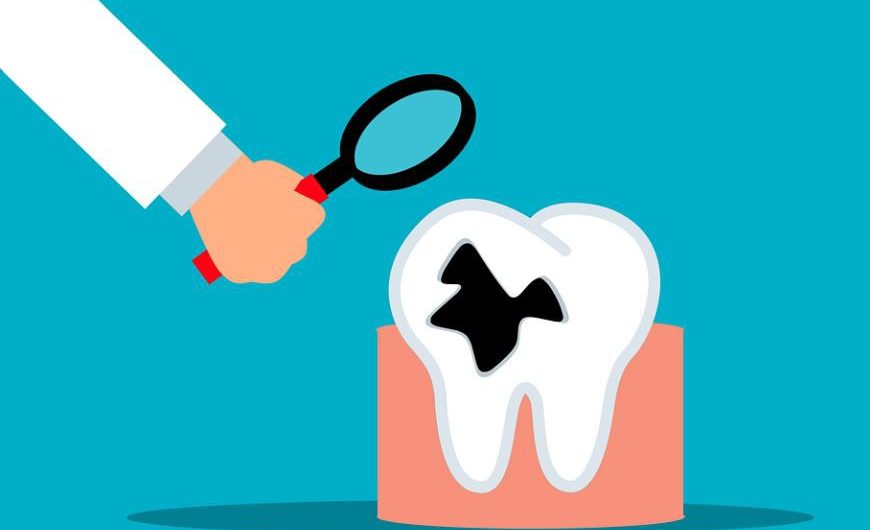 Rêver de dents pourries : 11 Interprétations et Symboles