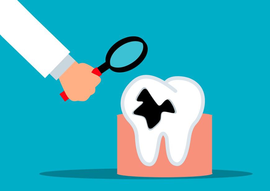 Rêver de dents pourries : 11 Interprétations et Symboles