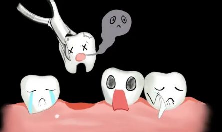 Rêvez d’extraire des dents chez le dentiste : 16 Interprétations et Symboles