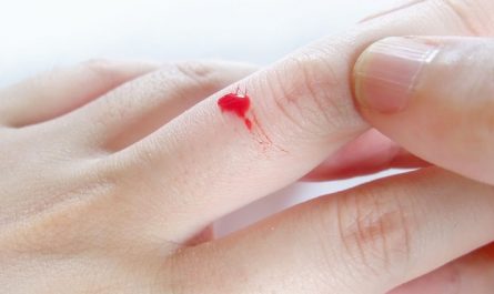 Rêver de doigts qui saignent : 18 Interprétations et Symboles