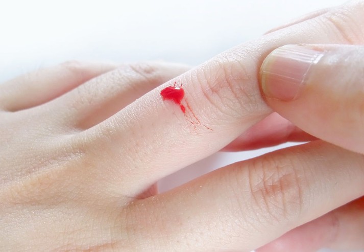 Rêver de doigts qui saignent : 18 Interprétations et Symboles