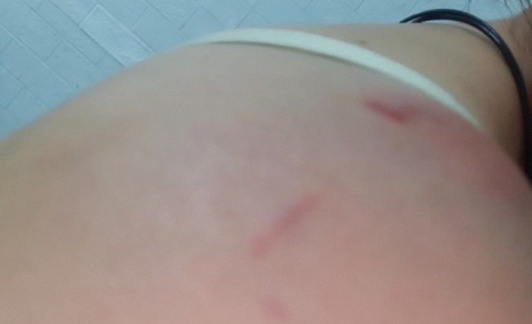 Rêver que ton mari te frappe : 11 Interprétations et Symboles