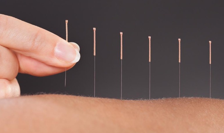 Rêver d'une clinique d'acupuncture : 21 Interprétations et Symboles